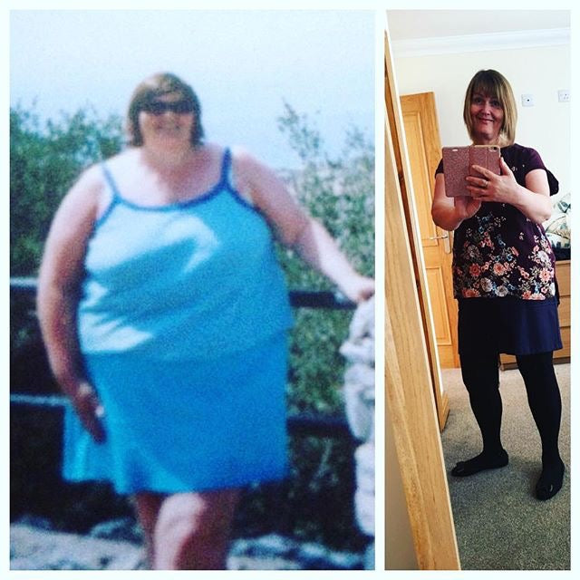 Weight Loss Before and After: Lesley Loses 96 Pounds And Gets Healthy